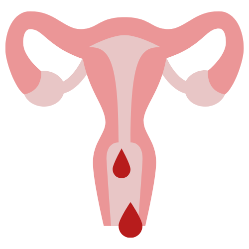 Heavy Periods (Menorrhagia)